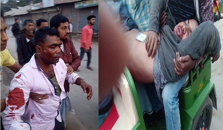 কোম্পানীগঞ্জে আ.লীগের দুপক্ষের সংঘর্ষে ৭ জন গুলিবিদ্ধসহ আহত ২০ কোম্পানীগঞ্জে আ.লীগের দুপক্ষের সংঘর্ষে ৭ জন গুলিবিদ্ধসহ আহত ২০