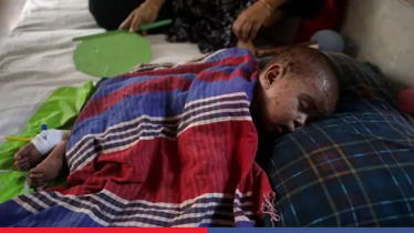 হাম ও উপসর্গে আরও ২ শিশুর মৃত্যু, প্রাণহানি ১ হাজার ৬৫