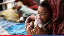 হাম ও উপসর্গে আরও ৮ শিশুর মৃত্যু, মোট প্রাণহানি ১০৩০