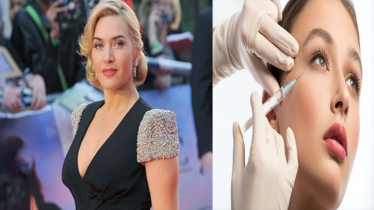 নারীদের বোটক্স কারার পক্ষে নন কেট উইন্সলেট