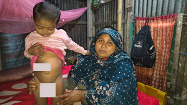 জন্ম থেকেই নেই পায়ুপথ, প্রতি নিঃশ্বাসে বাঁচার যুদ্ধ শিশু ওমরের