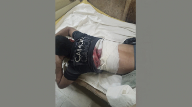নোয়াখালীতে ব্যবসায়ীকে গুলি করে মোটরসাইকেল ছিনতাই