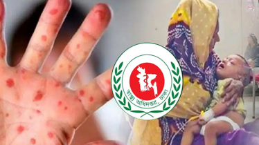 ২৪ ঘণ্টায় হামের উপসর্গে আরও ৪ শিশুর মৃত্যু, আক্রান্ত ১,১৩৭ ২৪ ঘণ্টায় হামের উপসর্গে আরও ৪ শিশুর মৃত্যু, আক্রান্ত ১,১৩৭