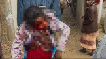 টেকনাফ সীমান্তে গুলিবিদ্ধ শিশু হুজাইফার ২৭ দিন পর মৃত্যু টেকনাফ সীমান্তে গুলিবিদ্ধ শিশু হুজাইফার ২৭ দিন পর মৃত্যু