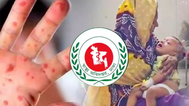 ২৪ ঘণ্টায় হামের উপসর্গে আরও ৪ শিশুর মৃত্যু, মোট প্রাণহানি ৮২০ ২৪ ঘণ্টায় হামের উপসর্গে আরও ৪ শিশুর মৃত্যু, মোট প্রাণহানি ৮২০