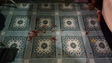 জয়পুরহাটে ধর্ষণ চেষ্টাকালে পুরুষের বিশেষ অঙ্গ কেটে দিলেন নারী জয়পুরহাটে ধর্ষণ চেষ্টাকালে পুরুষের বিশেষ অঙ্গ কেটে দিলেন নারী