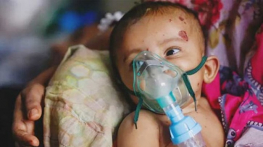 দেশে হামের ভয়াবহ প্রাদুর্ভাব, রাজশাহীতে মৃত্যু বেড়ে ১৫ দেশে হামের ভয়াবহ প্রাদুর্ভাব, রাজশাহীতে মৃত্যু বেড়ে ১৫