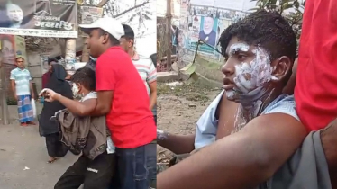 গাজীপুরে নির্বাচনী প্রচারণায় গ্যাস বেলুন বিস্ফোরণ, দগ্ধ ১৮