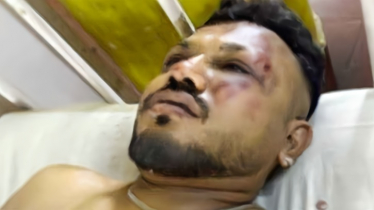 আহমেদাবাদে বিধ্বস্ত বিমান: বেঁচে ফিরলেন একজন