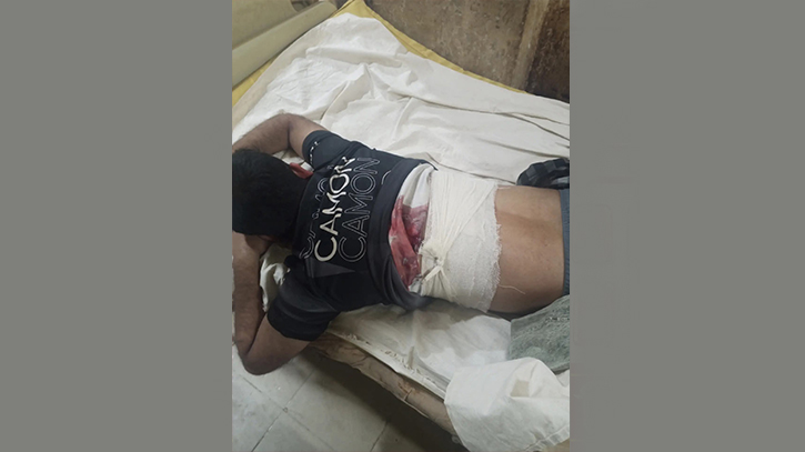 নোয়াখালীতে ব্যবসায়ীকে গুলি করে মোটরসাইকেল ছিনতাই