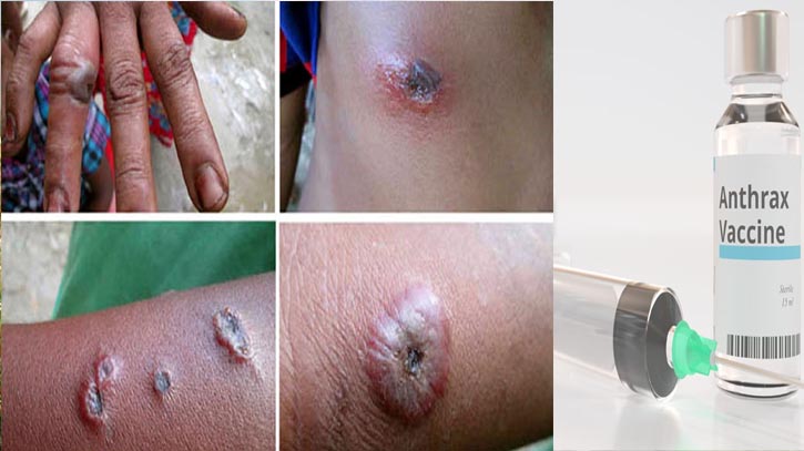 অ্যানথ্রাক্স প্রতিরোধে রংপুরে ৩০ লাখ টিকা প্রয়োগের প্রস্তুতি শুরু