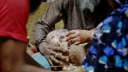 Measles outbreak claims 8 more children in 24 hours