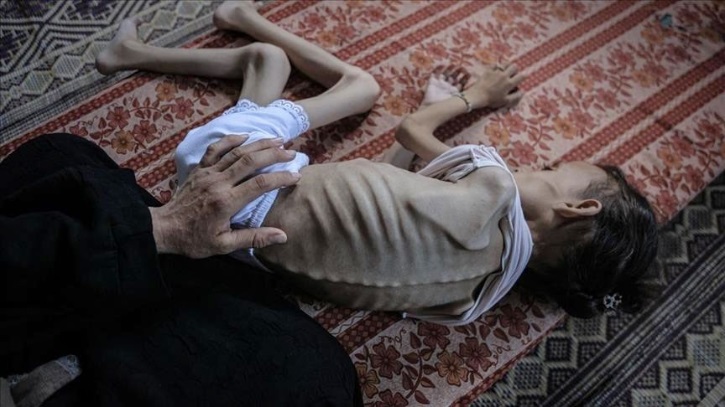 গাজায় একদিনে ৭৭ ফিলিস্তিনি নিহত