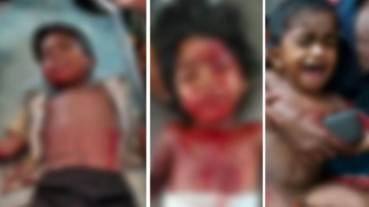 যশোরে ককটেল বিস্ফোরণে শিশুর মৃত্যু, আহত ২