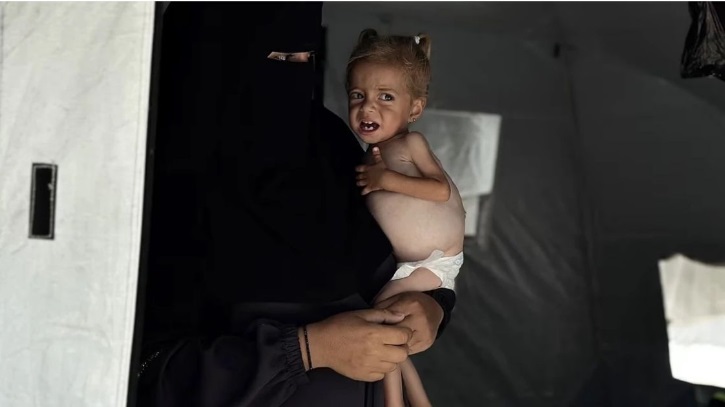 গাজায় দুধের তীব্র অভাব, মৃত্যুর ঝুঁকিতে শতাধিক শিশু