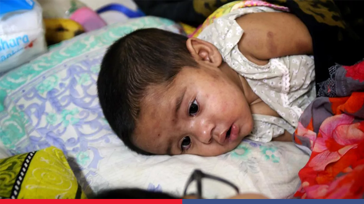 Measles death toll climbs to 1,104